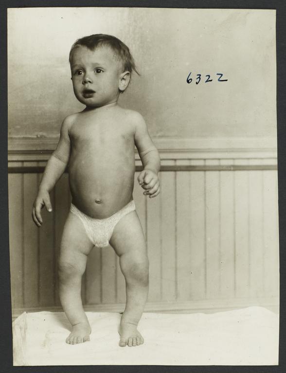Mulberry Health Center Album -- Standing Baby